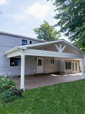 Outdoor Living- Addition