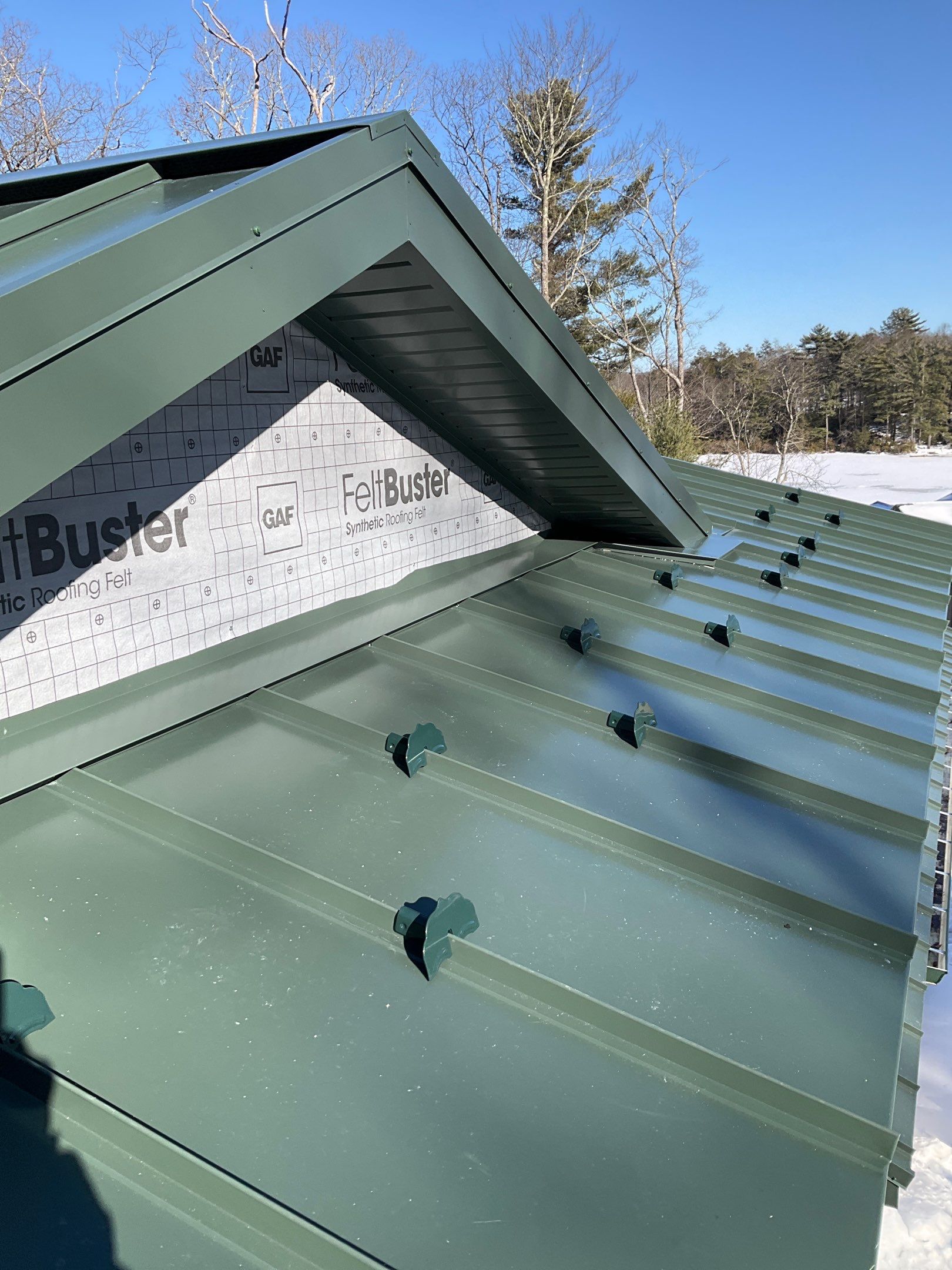 ABSeam Metal Roof by Esh Builders