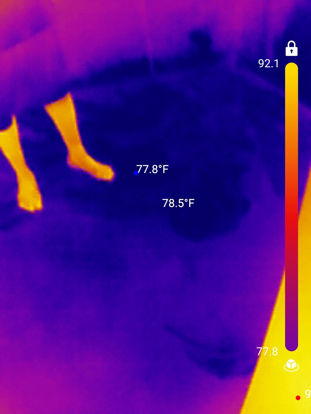Kitchen Water Damage Restoration and Structural Drying in Delray Beach by SuperClean 